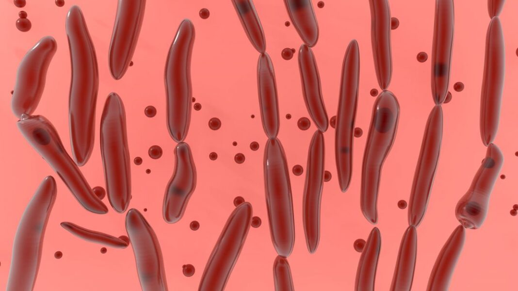 Μοντέλο προσομοίωσης ανάπτυξης Clostridium botulinum σε τρόφιμα - Cibum.gr