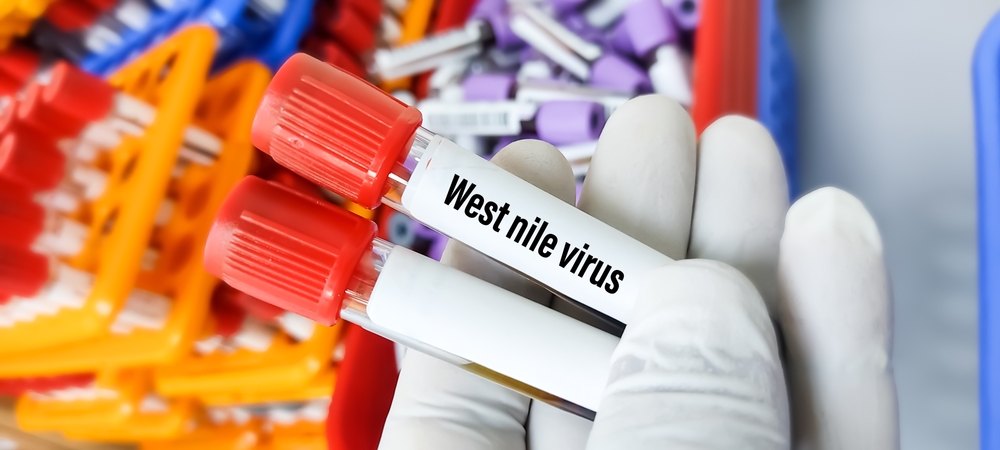 Grecia: 33 morti e 283 casi di virus West Nile – ATTENTI alle zanzare