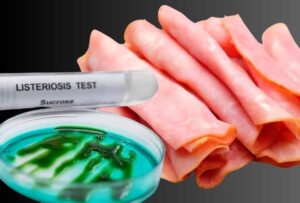 Ζαμπόν μολυσμένο με λιστέρια σε μεγάλο σουπερμάρκετ στη Γαλλία – Οι αρχές προειδοποιούν για συμπτώματα ακόμη και μετά από 8 εβδομάδες