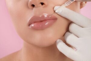Γιατί οι ειδικοί συνιστούν αποχή από τα fillers χειλιών στην εγκυμοσύνη