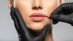 Botox στην Ελλάδα: Νέα εγκύκλιος του Υπουργείου Υγείας, αλλάζει τα δεδομένα