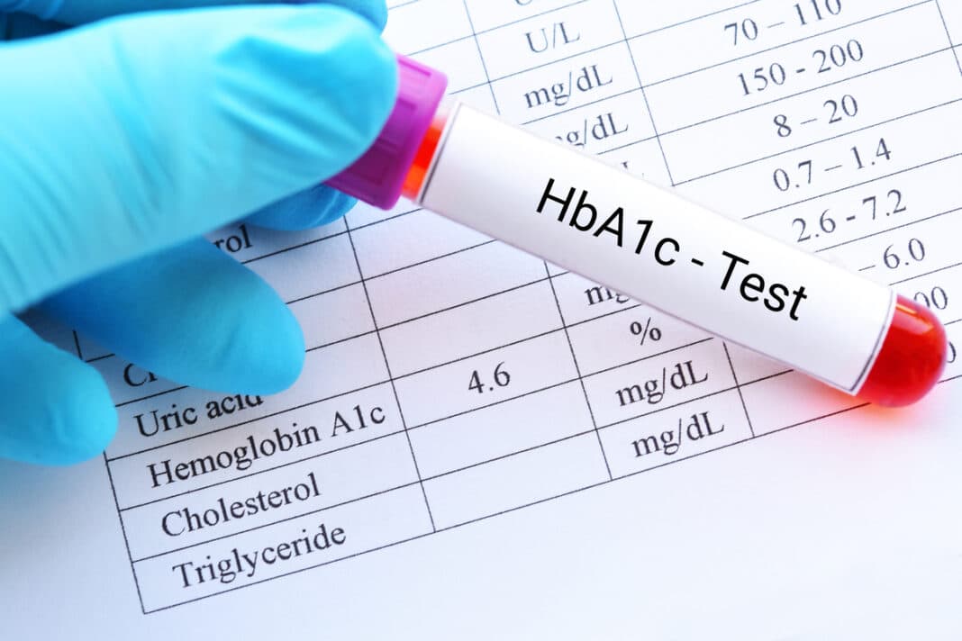 Σάκχαρο στο αίμα: Τι δείχνει η εξέταση HbA1c και γιατί έχει σημασία
