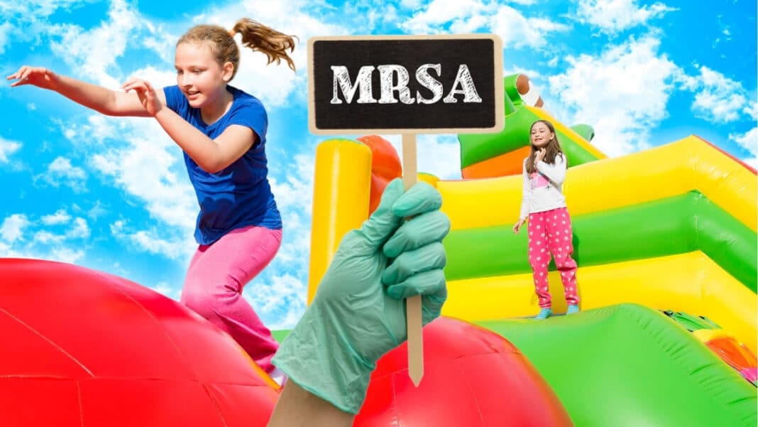 Πρωτοφανής έξαρση MRSA σε πάρτι με φουσκωτά: 48 παιδιά με φλύκταινες, φουσκάλες και αποστήματα - 4 στο νοσοκομείο