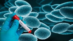 Μυστήριο με τον θάνατο 28χρονης σε εργαστήριο πανώλης στη Ρωσία – Τι λέει ο ΠΟΥ για το επίπεδο κινδύνου στην Ευρώπη